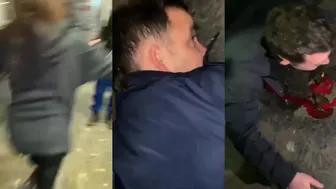 Dude Gets Bloodied Up After Spinning Elbow To The Face